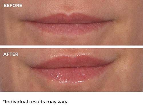 NassifMD Hydro-Screen for Lips