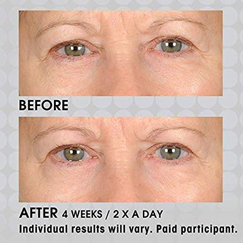 NassifMD Under Eye Smoother Firming Eye Cream, Anti Aging Eye Cream for Women, Under Eye Cream Dark Circles and Puffiness, Eye Serum Anti Aging Wrinkles